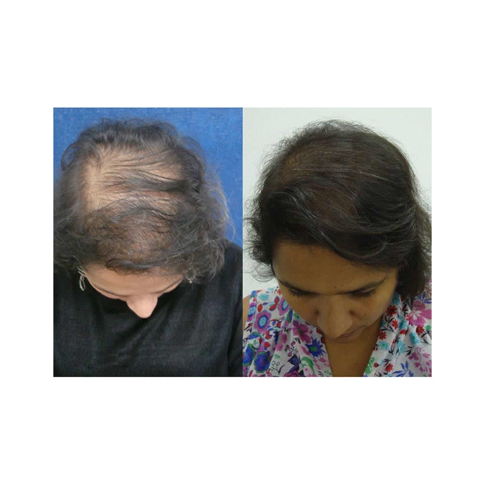 hair-package-3-179-web.png